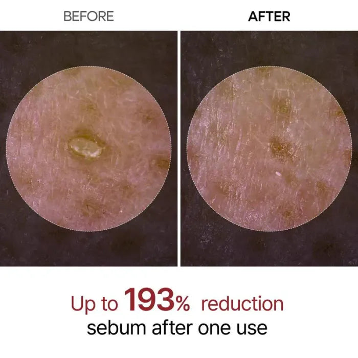 Rice Ampoule Peel Shot